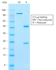 Data from SDS-PAGE analysis of Anti-Calponin-1 antibody (Clone rCNN1/832). Reducing lane (R) shows heavy and light chain fragments. NR lane shows intact antibody with expected MW of approximately 150 kDa. The data are consistent with a high purity, intact mAb.
